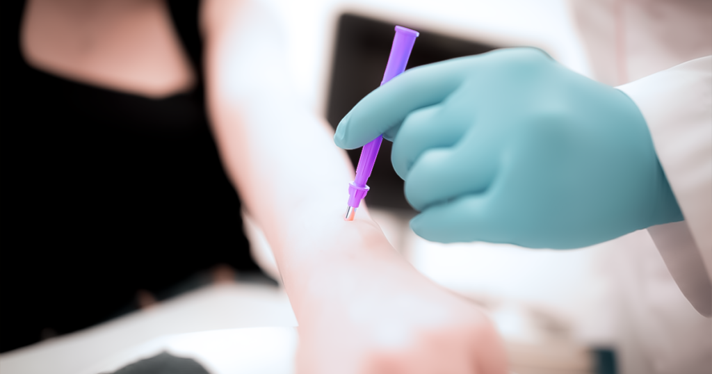 Մաշկի դակիչ բիոպսիա, punch biopsy